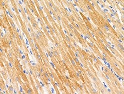 Invitrogen PAPPA2 Polyclonal Antibody 100 &mu;L | Buy Online | Invitrogen&trade; | Fisher Scientific