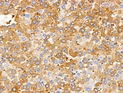 Invitrogen PAPPA2 Polyclonal Antibody 100 &mu;L | Buy Online | Invitrogen&trade; | Fisher Scientific