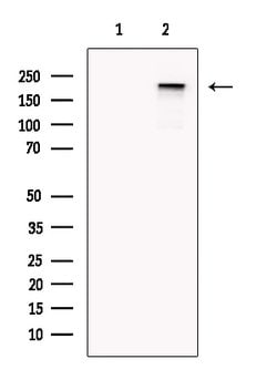 Invitrogen PAPPA2 Polyclonal Antibody 100 &mu;L | Buy Online | Invitrogen&trade; | Fisher Scientific