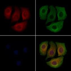 Invitrogen PCSK9 Polyclonal Antibody 100 &mu;L; Unconjugated:Antibodies,