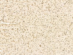 Invitrogen PDE1C Polyclonal Antibody 100 &mu;L; Unconjugated:Antibodies,
