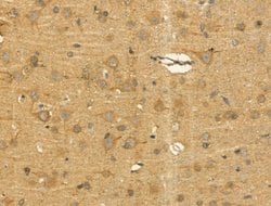 Invitrogen Pericentrin Polyclonal Antibody 100 &mu;L; Unconjugated:Antibodies,