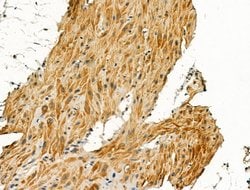 Invitrogen Pericentrin Polyclonal Antibody 100 &mu;L; Unconjugated:Antibodies,