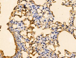 Invitrogen PFDN6 Polyclonal Antibody 100 &mu;L; Unconjugated:Antibodies,