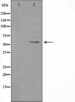 Invitrogen PFKFB2 Polyclonal Antibody 100 &mu;L | Buy Online | Invitrogen&trade; | Fisher Scientific