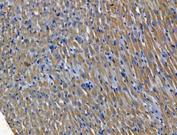 Invitrogen PGAM2 Polyclonal Antibody 100 &mu;L; Unconjugated:Antibodies,
