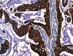 Invitrogen PGAM2 Polyclonal Antibody 100 &mu;L; Unconjugated:Antibodies,