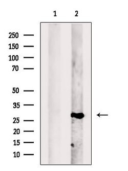 Invitrogen PGAM2 Polyclonal Antibody 100 &mu;L; Unconjugated:Antibodies,