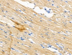 Invitrogen PGAM5 Polyclonal Antibody 100 &mu;L; Unconjugated:Antibodies,