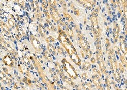 Invitrogen PTGES Polyclonal Antibody 100 μL; Unconjugated:Antibodies,