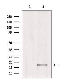Invitrogen PTGES Polyclonal Antibody 100 μL; Unconjugated:Antibodies,
