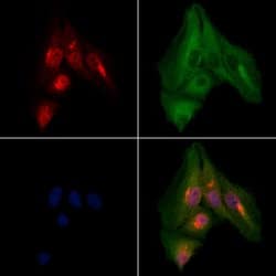 Invitrogen PGP Polyclonal Antibody 100 &mu;L; Unconjugated:Antibodies,