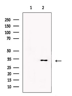 Invitrogen PGP Polyclonal Antibody 100 &mu;L; Unconjugated:Antibodies,