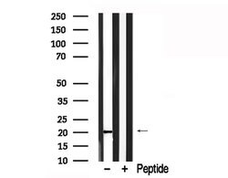 Invitrogen Phospholamban Polyclonal Antibody 100 &mu;L | Buy Online | Invitrogen&trade; | Fisher Scientific