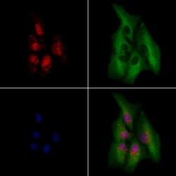 Invitrogen PHOX2B Polyclonal Antibody 100 &mu;L; Unconjugated:Antibodies,