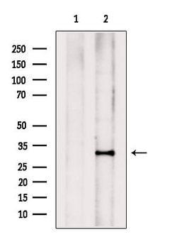 Invitrogen PHOX2B Polyclonal Antibody 100 &mu;L; Unconjugated:Antibodies,