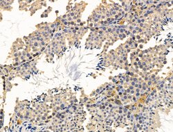 Invitrogen CALM Polyclonal Antibody 100 &mu;L; Unconjugated:Antibodies,