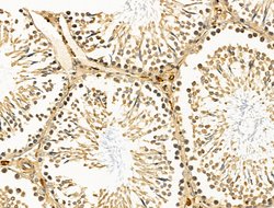 Invitrogen CALM Polyclonal Antibody 100 &mu;L; Unconjugated:Antibodies,