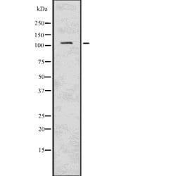 Invitrogen PIK3CD Polyclonal Antibody 100 &mu;L; Unconjugated:Antibodies,