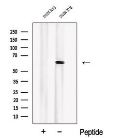 Invitrogen PIP5K1B Polyclonal Antibody 100 &mu;L; Unconjugated:Antibodies,