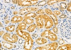 Invitrogen PIWIL4 Polyclonal Antibody 100 &mu;L; Unconjugated:Antibodies,