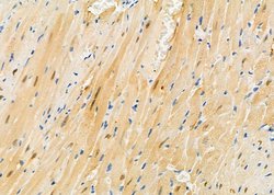 Invitrogen PIWIL4 Polyclonal Antibody 100 &mu;L; Unconjugated:Antibodies,