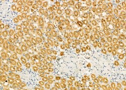 Invitrogen PIWIL4 Polyclonal Antibody 100 &mu;L; Unconjugated:Antibodies,