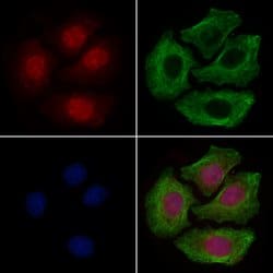 Invitrogen PKA alpha Polyclonal Antibody 100 &mu;L; Unconjugated:Antibodies,
