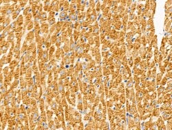 Invitrogen PKA alpha Polyclonal Antibody 100 &mu;L; Unconjugated:Antibodies,
