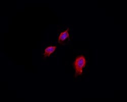 Invitrogen PKA C alpha/beta Polyclonal Antibody 100 &mu;L; Unconjugated:Antibodies,