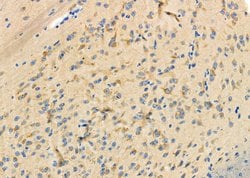 Invitrogen PKA C alpha/beta Polyclonal Antibody 100 &mu;L; Unconjugated:Antibodies,