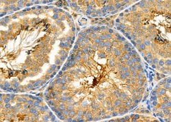 Invitrogen PKA C alpha/beta Polyclonal Antibody 100 &mu;L; Unconjugated:Antibodies,