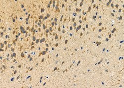 Invitrogen PKA C alpha/beta Polyclonal Antibody 100 &mu;L; Unconjugated:Antibodies,