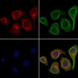 Invitrogen PKC delta Polyclonal Antibody 100 μL; Unconjugated:Antibodies,