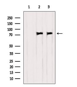 Invitrogen PKC delta Polyclonal Antibody 100 μL; Unconjugated:Antibodies,