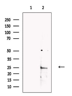 Invitrogen CSH2 Polyclonal Antibody 100 &mu;L; Unconjugated:Antibodies,