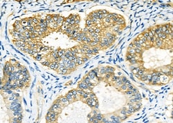 Invitrogen PLCD1 Polyclonal Antibody 100 μL; Unconjugated:Antibodies,