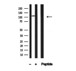 Invitrogen PLD1 Polyclonal Antibody 100 &mu;L; Unconjugated:Antibodies,
