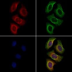 Invitrogen PLXNA4 Polyclonal Antibody 100 &mu;L; Unconjugated:Antibodies,
