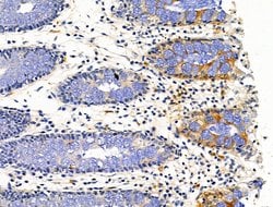 Invitrogen PLXNA4 Polyclonal Antibody 100 &mu;L; Unconjugated:Antibodies,