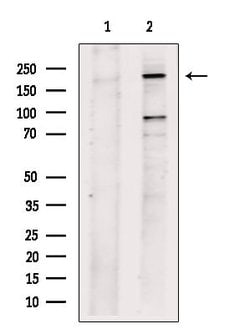 Invitrogen PLXND1 Polyclonal Antibody 100 &mu;L; Unconjugated:Antibodies,