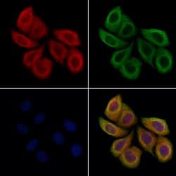 Invitrogen PLVAP Polyclonal Antibody 100 &mu;L; Unconjugated:Antibodies,