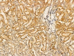 Invitrogen PLVAP Polyclonal Antibody 100 &mu;L; Unconjugated:Antibodies,
