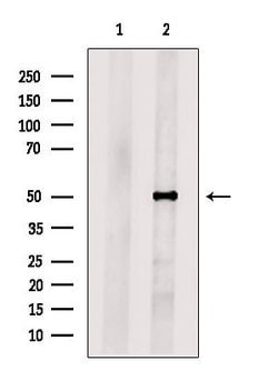 Invitrogen PLVAP Polyclonal Antibody 100 &mu;L; Unconjugated:Antibodies,