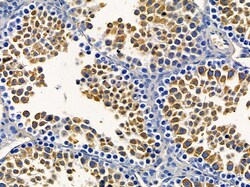 Invitrogen PNPase Polyclonal Antibody 100 &mu;L; Unconjugated:Antibodies,