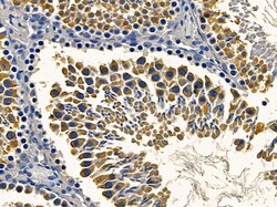 Invitrogen PNPase Polyclonal Antibody 100 &mu;L; Unconjugated:Antibodies,