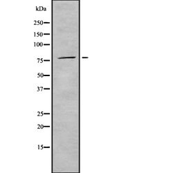 Invitrogen PNPase Polyclonal Antibody 100 &mu;L; Unconjugated:Antibodies,