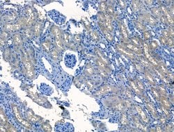 Invitrogen Polycystin 1 Polyclonal Antibody 100 &mu;L; Unconjugated:Antibodies,