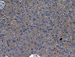 Invitrogen Polycystin 1 Polyclonal Antibody 100 &mu;L; Unconjugated:Antibodies,