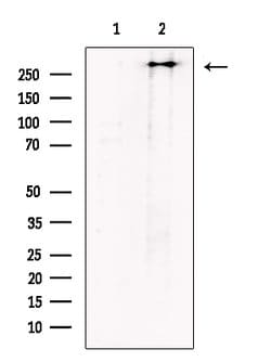 Invitrogen Polycystin 1 Polyclonal Antibody 100 &mu;L; Unconjugated:Antibodies,